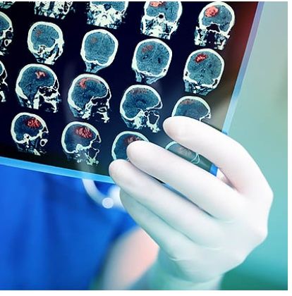 Неврология