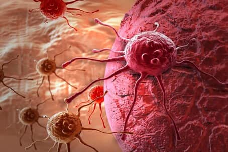 Есть ли жизнь после рака