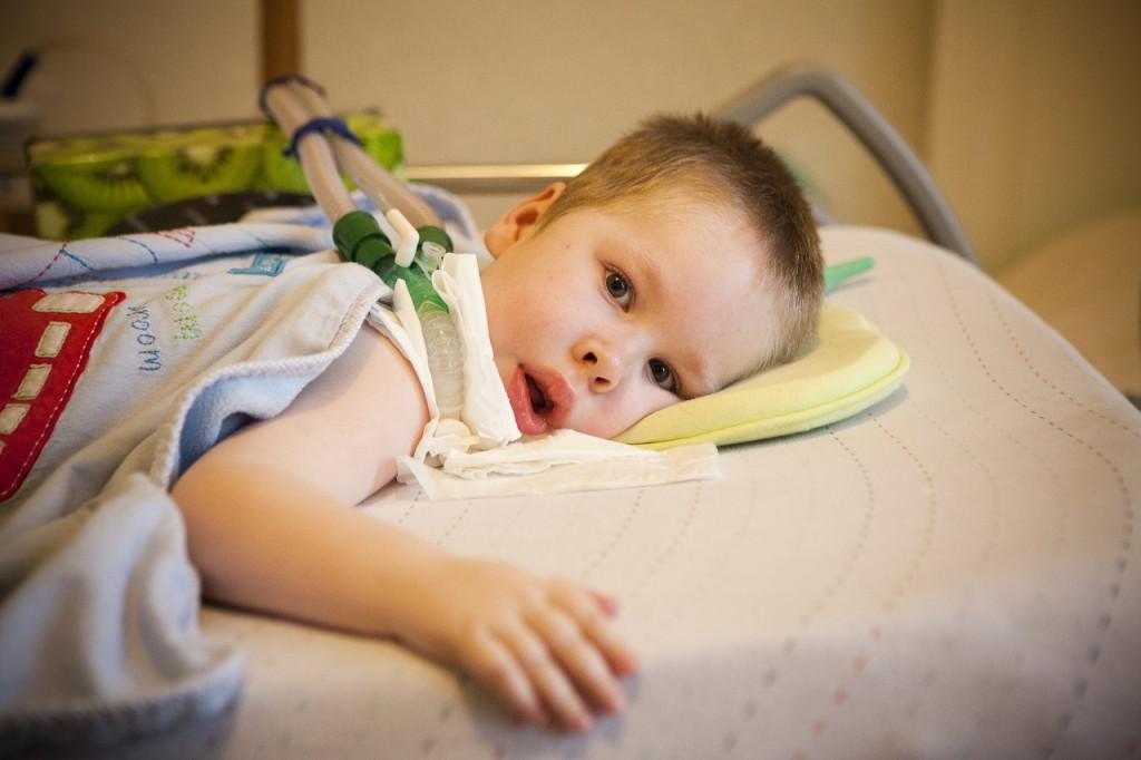 Спинальная мышечная атрофия