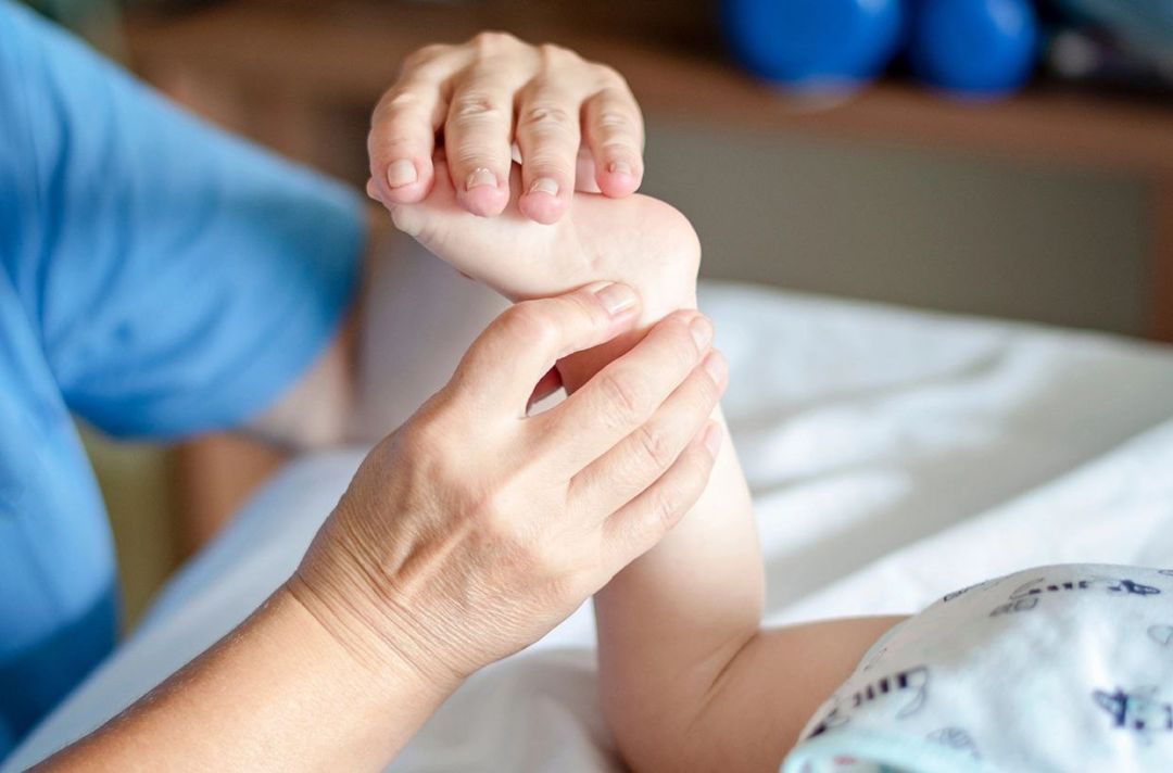 Детский церебральный паралич