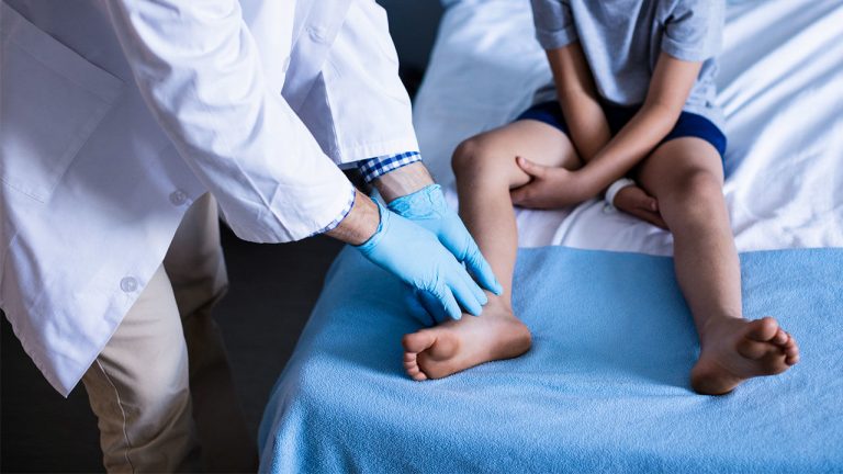 Мышечная дистрофия Дюшенна