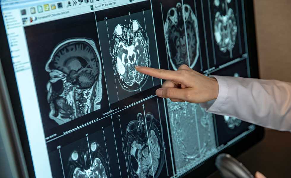 Технологии в лечении рака