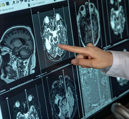 Технологии в лечении рака