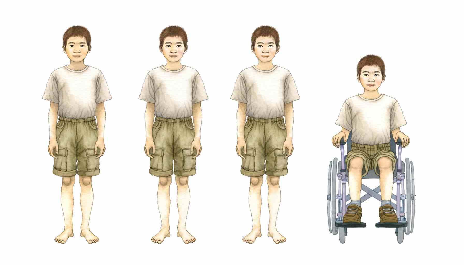 Классификация ДЦП