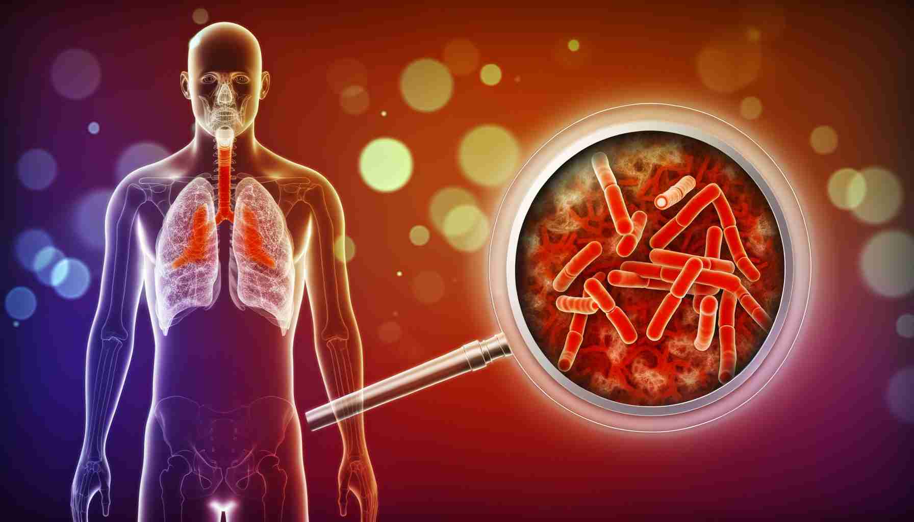 В России увеличилась смертность от туберкулеза