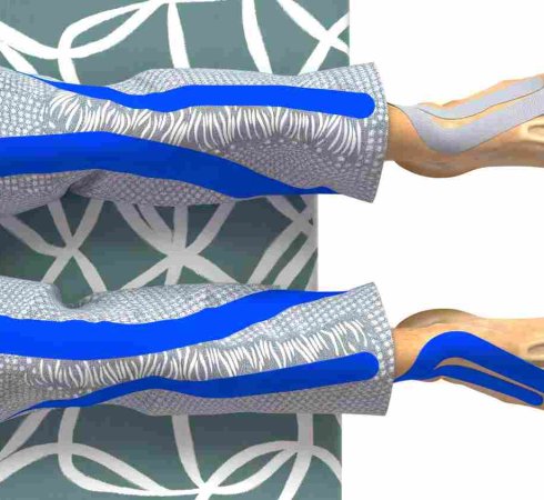 Тейпирование при ДЦП