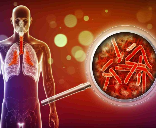 В России увеличилась смертность от туберкулеза